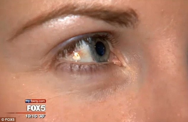 Девушка установила себе в глаз ювелирный имплантат