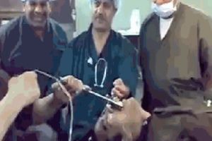 Мужик проглотил гаечный ключ