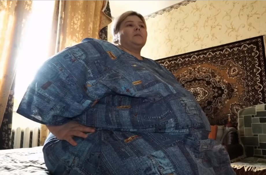 Самой тяжелой женщине России сделали операцию