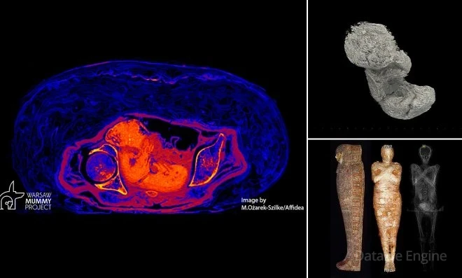 Египетская мумия с 28-недельной беременностью, которая сохранялась 2000 лет